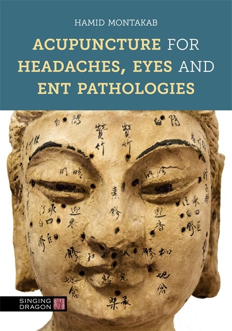 Acupuncture for headaches