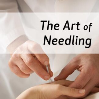 The Art of Needling