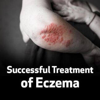 Successful Treatment of Eczema